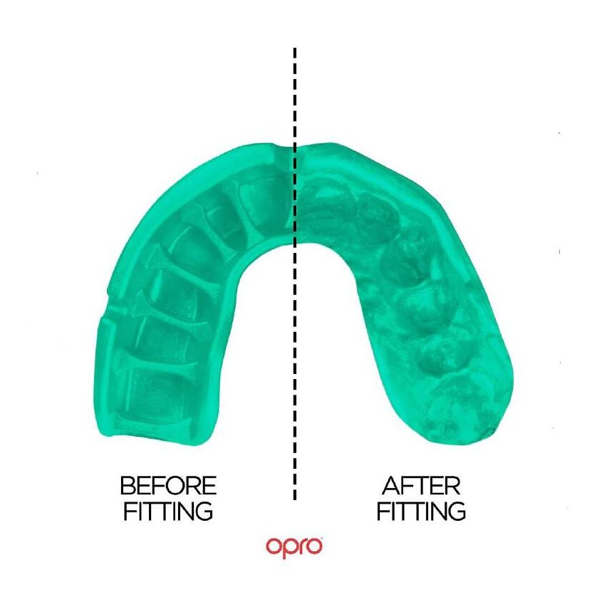 Opro Mouthguard Self- Fit Gen4 Full Pack Gold Adult