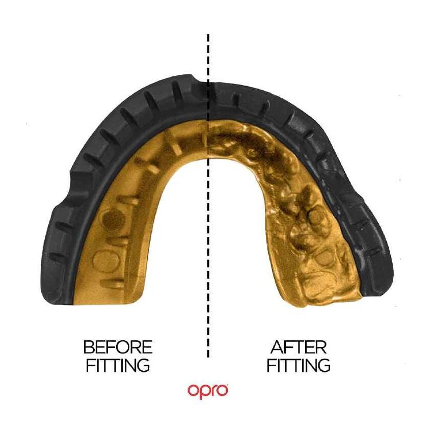 Opro Mouthguard Self-Fit Gen4 Full Pack Gold Braces